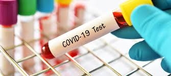 Coronavirus, da martedì i test sierologici presso i centri autorizzati. Ecco come farli